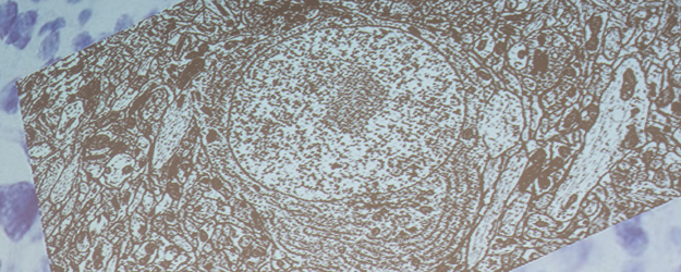 Elektronenmikroskopaufnahme des Gehirns:  Elektronenmikroskopaufnahme des Gehirns: